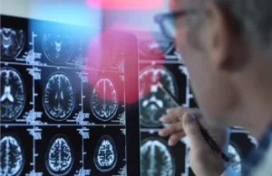 أسئلة بسيطة لمعرفة العلامات المبكرة لألزهايمر أسئلة بسيطة لمعرفة العلامات المبكرة لألزهايمر